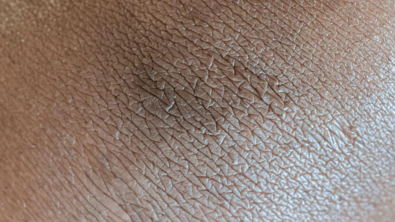 Humidity and Dry Skin Explained